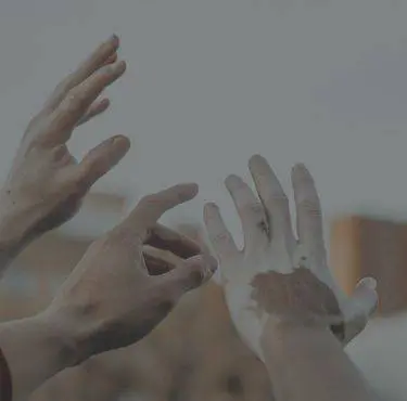En hand med vitiligo.