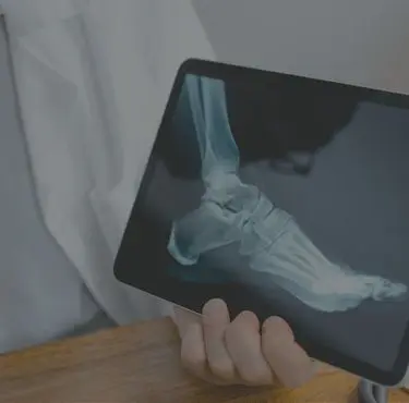 Doktor håller upp en röntgenbild på en fot