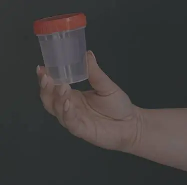 En hand håller upp en burk avsedd för urinprov.