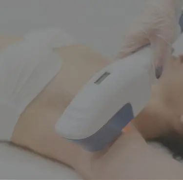 En patient får behandling med laser.