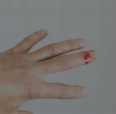 En hand med ett blödande finger.