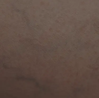 Blodådror i närbild.