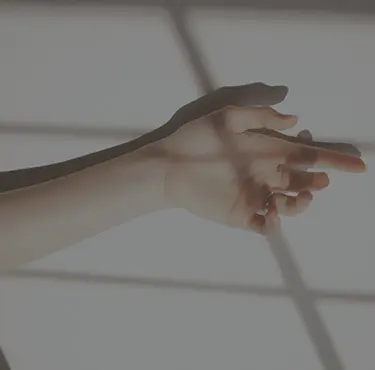 En person med Marfans syndrom visar sin arm.