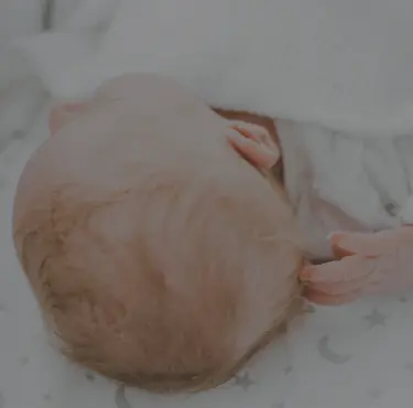 Ett nyfött barn med Turners syndrom.